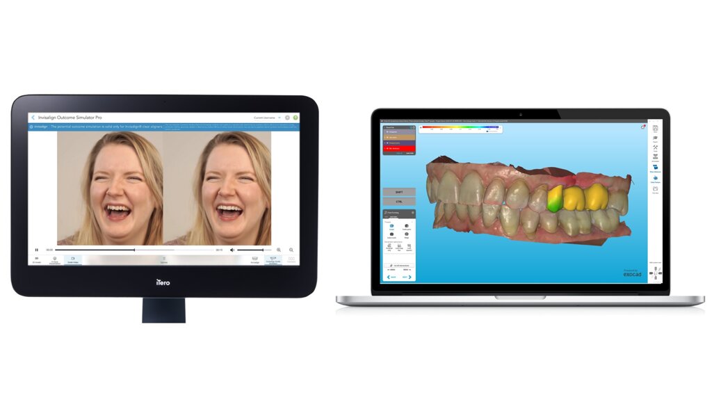 Align Technology presenta innovazioni per l’ecosistema digitale iTero e l’esperienza del paziente