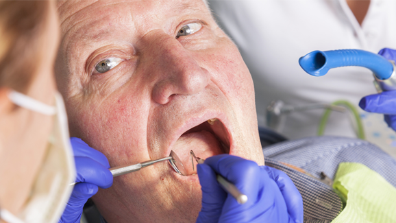 Pflegeheimbewohner lehnen Zahnbehandlungen häufig ab
