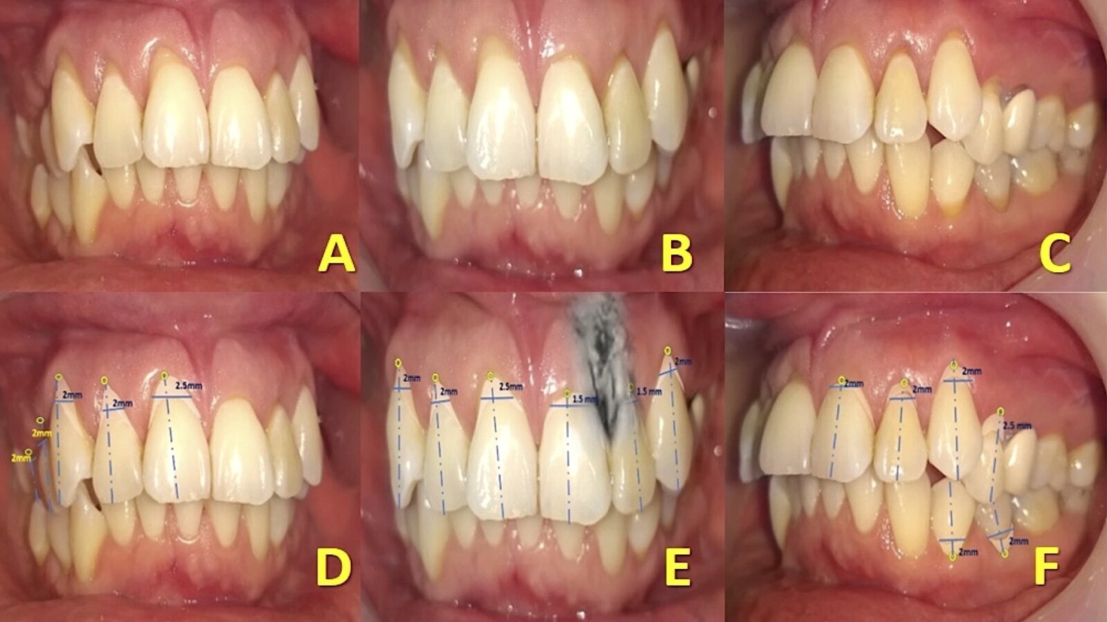 La línea de la belleza del rostro
