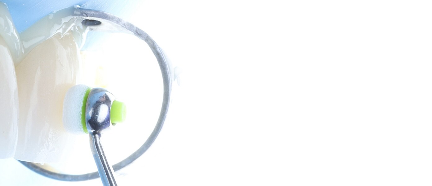 Fig. 19a: Controlled seating of the veneer using a cushioned instrument to ensure complete adaptation. 