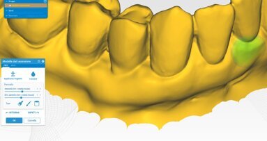 Valutazione CAD dei cambiamenti dimensionali dopo l’utilizzo di matrici in collagene
