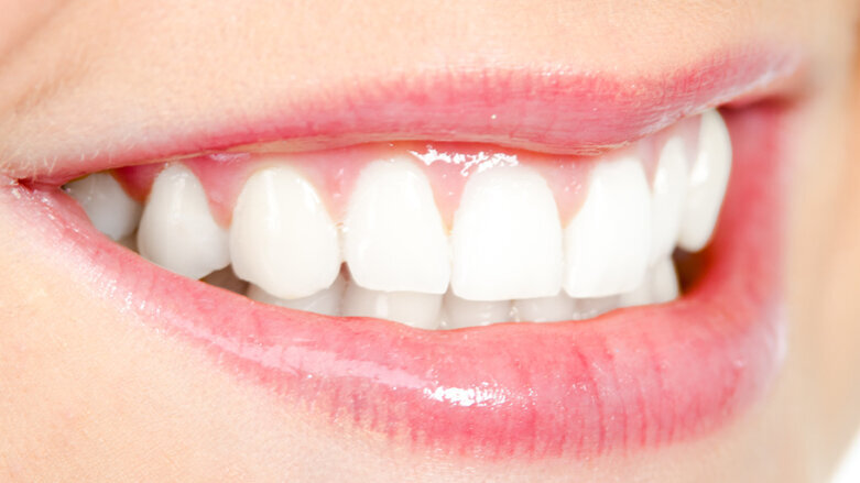 Früherkennung von Zwischenraumkaries mit Infrarotlicht getestet