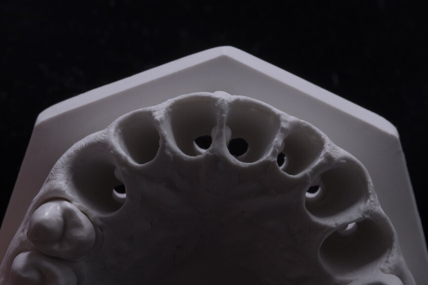 Fig. 62: Alveolar model.