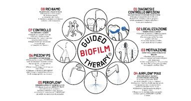Alla conquista del biofilm sui brackets