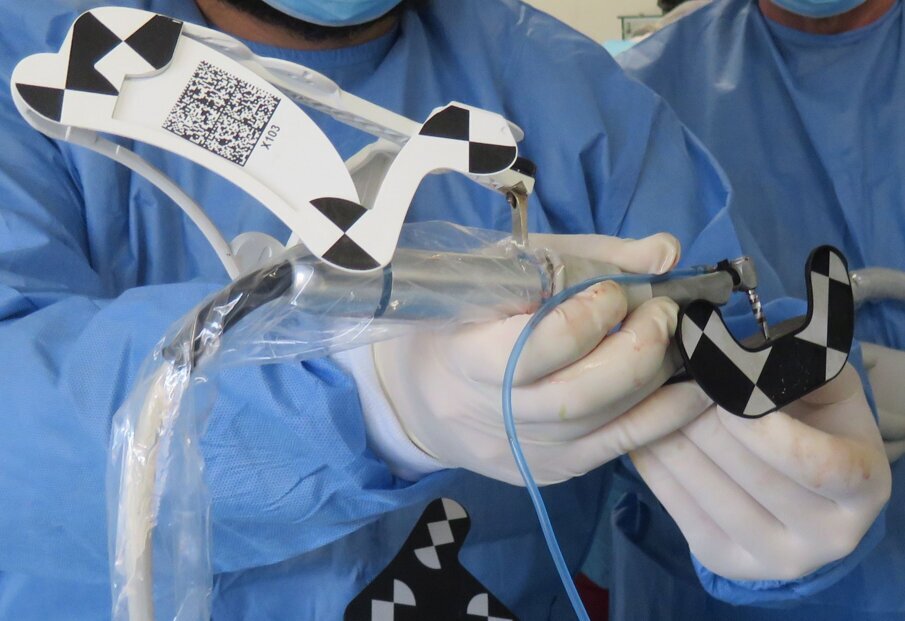 Figg. 10a-10g - Il Drill Tag peculiarità del Navident (a). Questo dispositivo consente di guidare qualsiasi strumento chirurgico. Non potendo essere note a priori le caratteristiche geometriche tridimensionali dello strumento lavorante è necessaria una calibrazione preliminare al gesto chirurgico (b-d). Esempio di navigazione di un Magnetic Mallet (e). Supporto software che consente l’identificazione delle diverse possibili tipologie di strumenti chirurgici guidati (f, g).