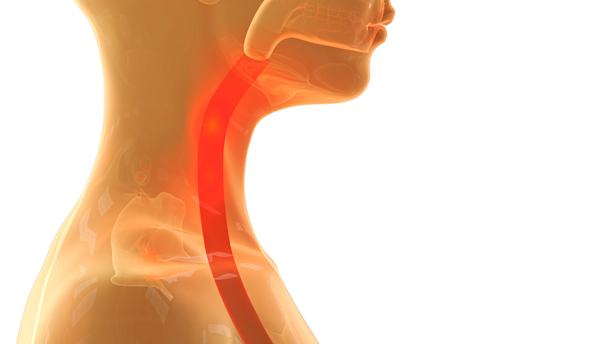 Verschluckte Prothese blockiert Speiseröhre