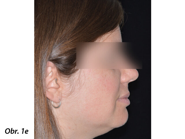 Pacientka 1 – Počáteční fotografie.