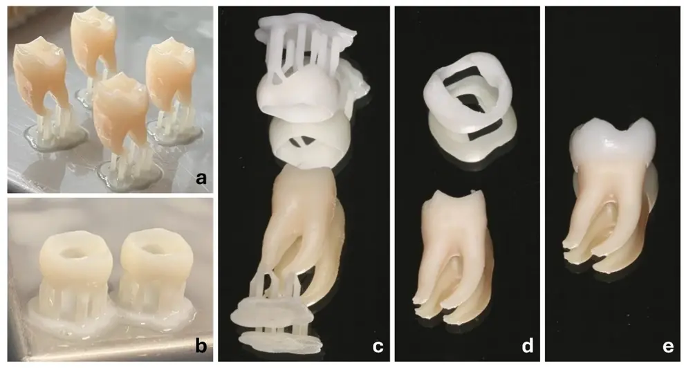 3D-printed practice tooth post-processing. (a) Dentine parts with resin residue on the build platform. (b) Enamel parts with resin residue on the build platform. (c) Washed enamel and dentine parts with supporting structures. (d) Enamel and dentine parts prepared for assembly. (e) Assembled tooth. (Image: © 2025 Di Lorenzo et al., licensed under CC BY 4.0)