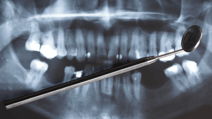 Stimulation von Knochengewebe durch Zahnschmelz-Protein Stimulation von Knochengewebe durch Zahnschmelz-Protein