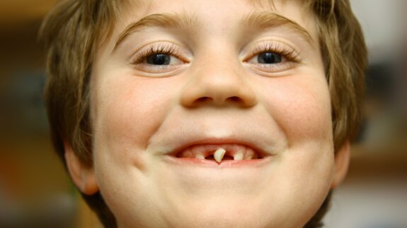 Bijna één op de vijf kinderen niet naar tandarts