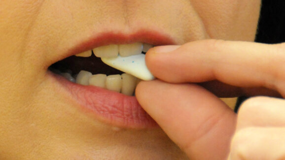 Kaugummi als Frühwarnsystem bei Implantatkomplikation