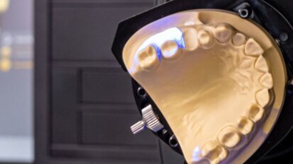 O futuro das restaurações dentárias: vantagens dos sistemas CAD/CAM