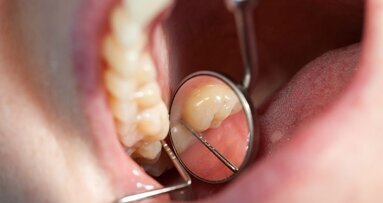 Commentaar gevraagd op conceptrichtlijn Derde molaar