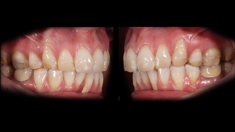 Ricostruzioni estetiche complesse: metodi digitali e protocolli operativi integrati