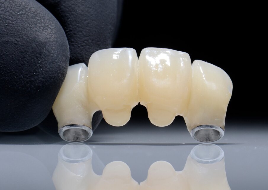 Fig. 62 - Provvisorio e precisione. 