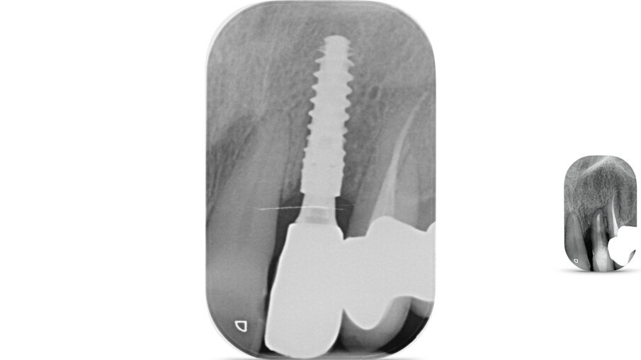 Fig. 16_Controllo Rx post-consegna.