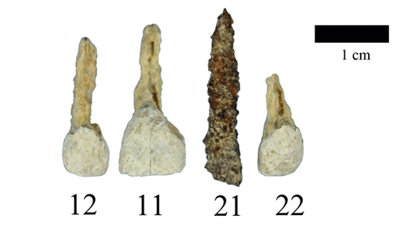 Ältestes Implantat Westeuropas entdeckt