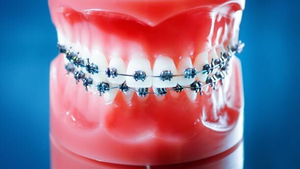 Strengere eisen voor buitenlandse tandarts-specialisten