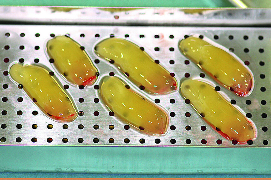 Fig. 8: The properly compressed PRF membranes permitted complete coverage of the surgical site, in this instance on the maxilla.