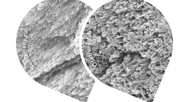 Remineralizace: preventivní a terapeutický přístup v managementu tvrdých zubních tkání