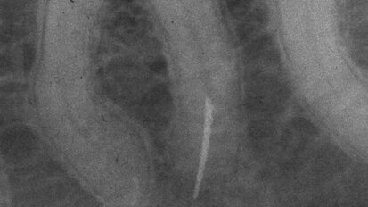 A critical assessment of endodontic armamentarium A critical assessment of endodontic armamentarium
