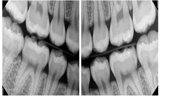 Wireless digital radiography system earns tech award