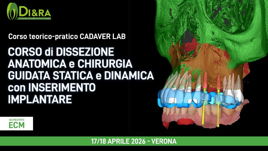 Corso di dissezione anatomica e chirurgia guidata statica e dinamica con inserimento implantare