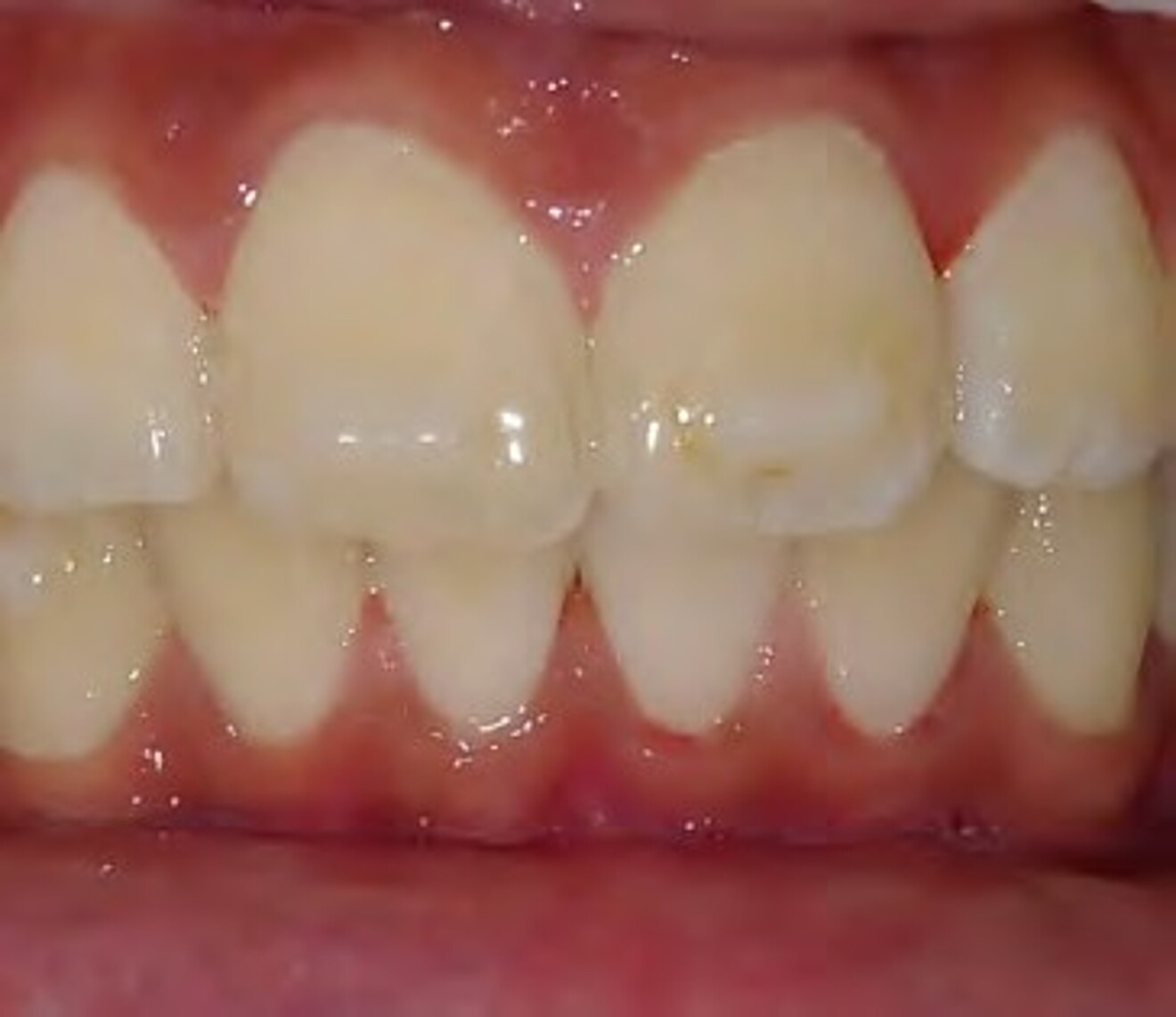 3f