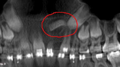 Straight talk on 3-D imaging from an orthodontist