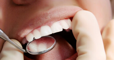 Η επίδραση της τάσης κυκλικής κόπωσης-βιοδιάβρωσης στις μη τερηδονικές αυχενικές  βλάβες