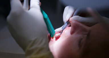 Interview: This work helps us understand acute periodontal pathogens