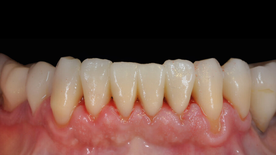 Fig. 7_Restauro dopo 7 anni.