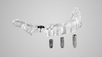 Dentsply Sirona Implants lancia Acuris, l’innovazione più recente nel campo dell’implantologia