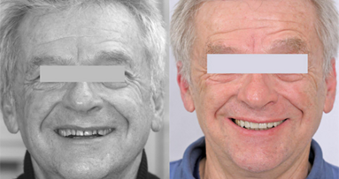 Daily work with Coachman’s Digital Smile Design protocol