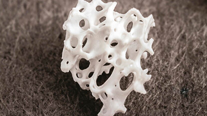 Più spazio per l'osso vitale