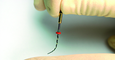 A short history of the NiTi file revolution