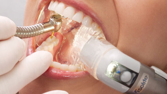 Isolite delivers dental isolation technology