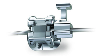 Ormco announces launch of the first and only repositionable hook on the market