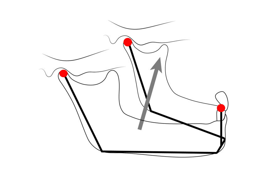 Fig. 3: A drawing of the mandible, anterior teeth and fossae, showing a reversed tripod.