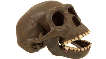 Kariesbehandlung schon in der Jungsteinzeit Kariesbehandlung schon in der Jungsteinzeit