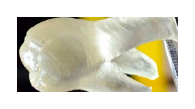 Stampati e senza carie: i nostri denti del futuro