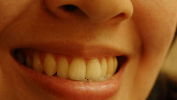 Solving how harmless bacteria become an unwelcome guest