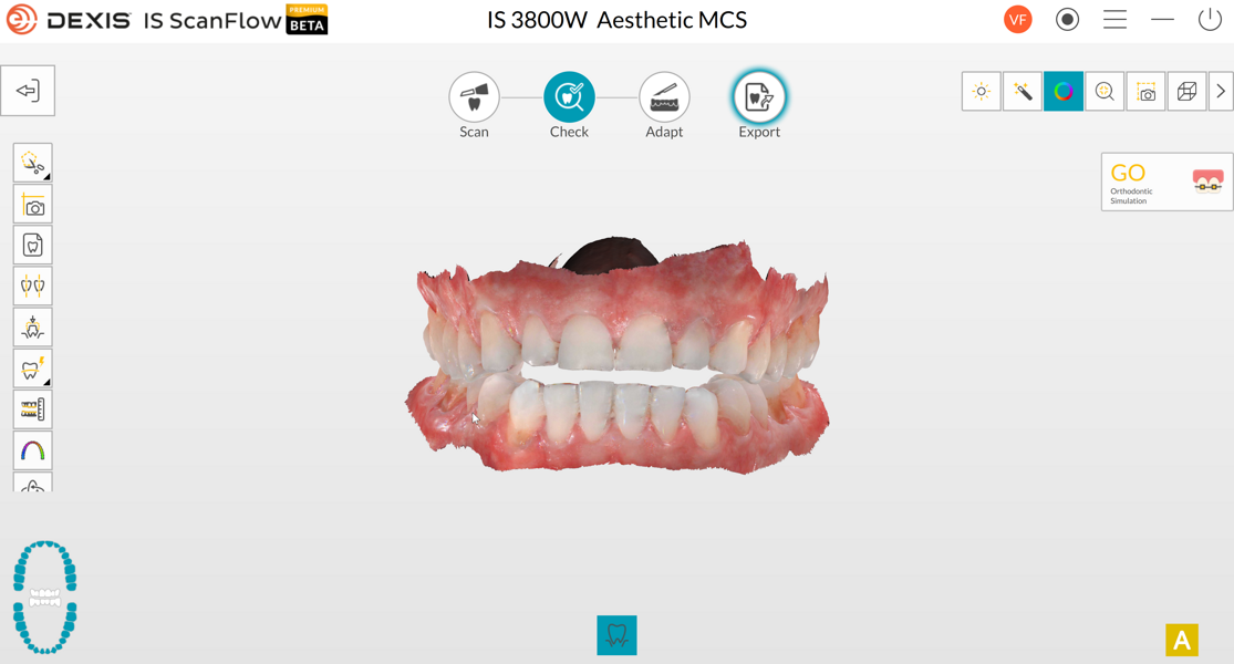 Fig. 3: Digital impression of the occlusion.