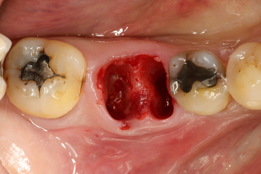 Fig. 5: Socket dimensions preserved.