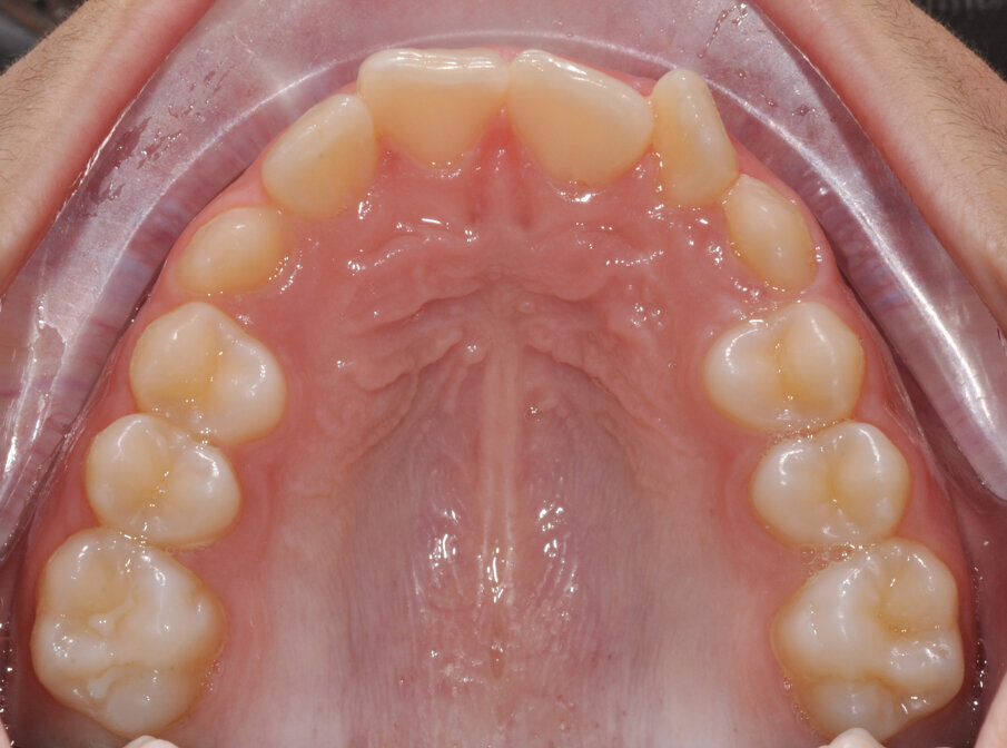 Fig. 20_Completamento della permuta.