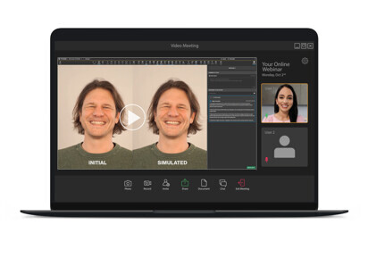 Align Technology – Invisalign Smile Video