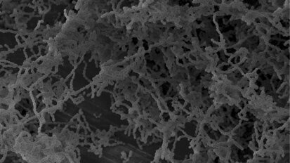 Antiseptika: Resistente Mikroben im Mund erforschen Antiseptika: Resistente Mikroben im Mund erforschen