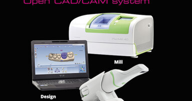 Restauraciones perfectas en una sola cita