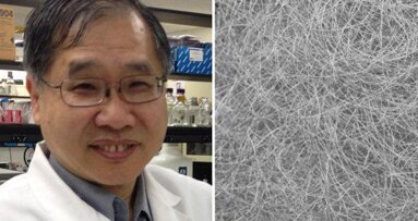 Тъканно инженерство: Копринени нишки биха могли да помогнат за регенeрацията на клетките на слюнчените жлези