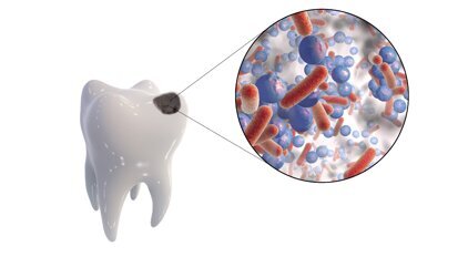 Si può crescere senza carie a costo 0 o con pochi centesimi al giorno